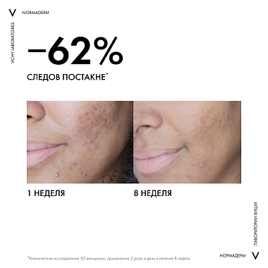 Купить Vichy Normaderm Phytosolution 50 мл уход корректирующий двойного действия