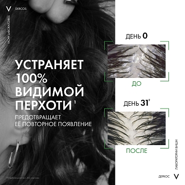 Купить Vichy Dercos DS 75 мл шампунь-уход против перхоти для нормаальных и жирных волос