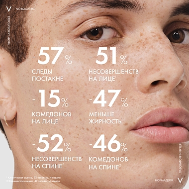 Купить Vichy Normaderm 125 мл гель для лица очищающий с пилингом